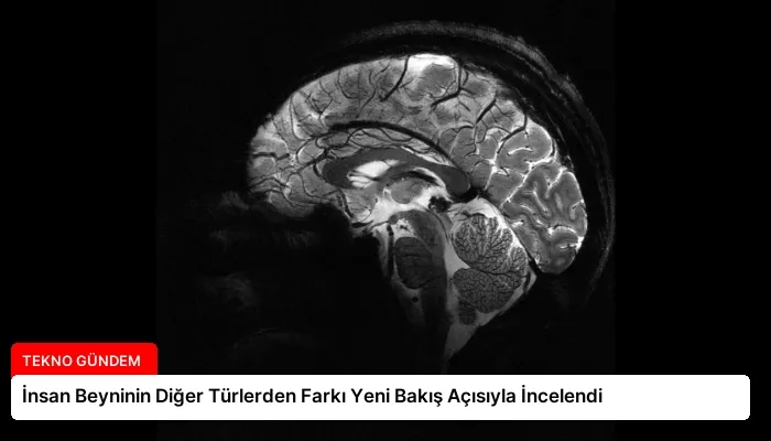 İnsan Beyninin Diğer Türlerden Farkı Yeni Bakış Açısıyla İncelendi